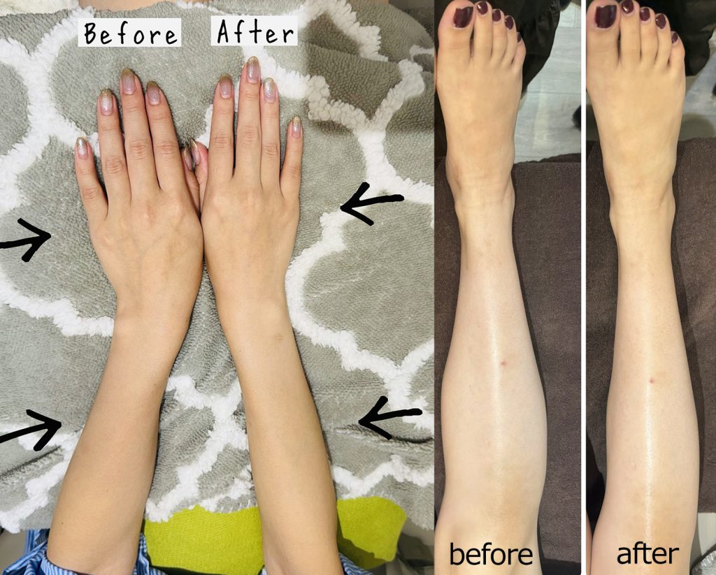 瞬間美脚ネイルコース