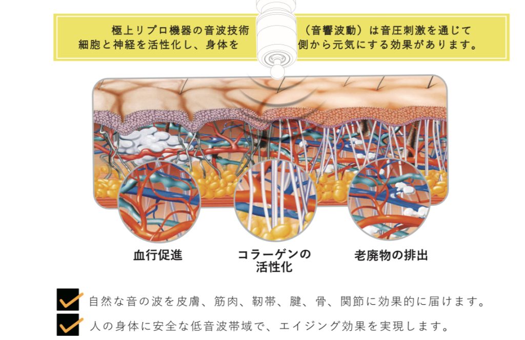 極上リプロ機器の音波技術説明図