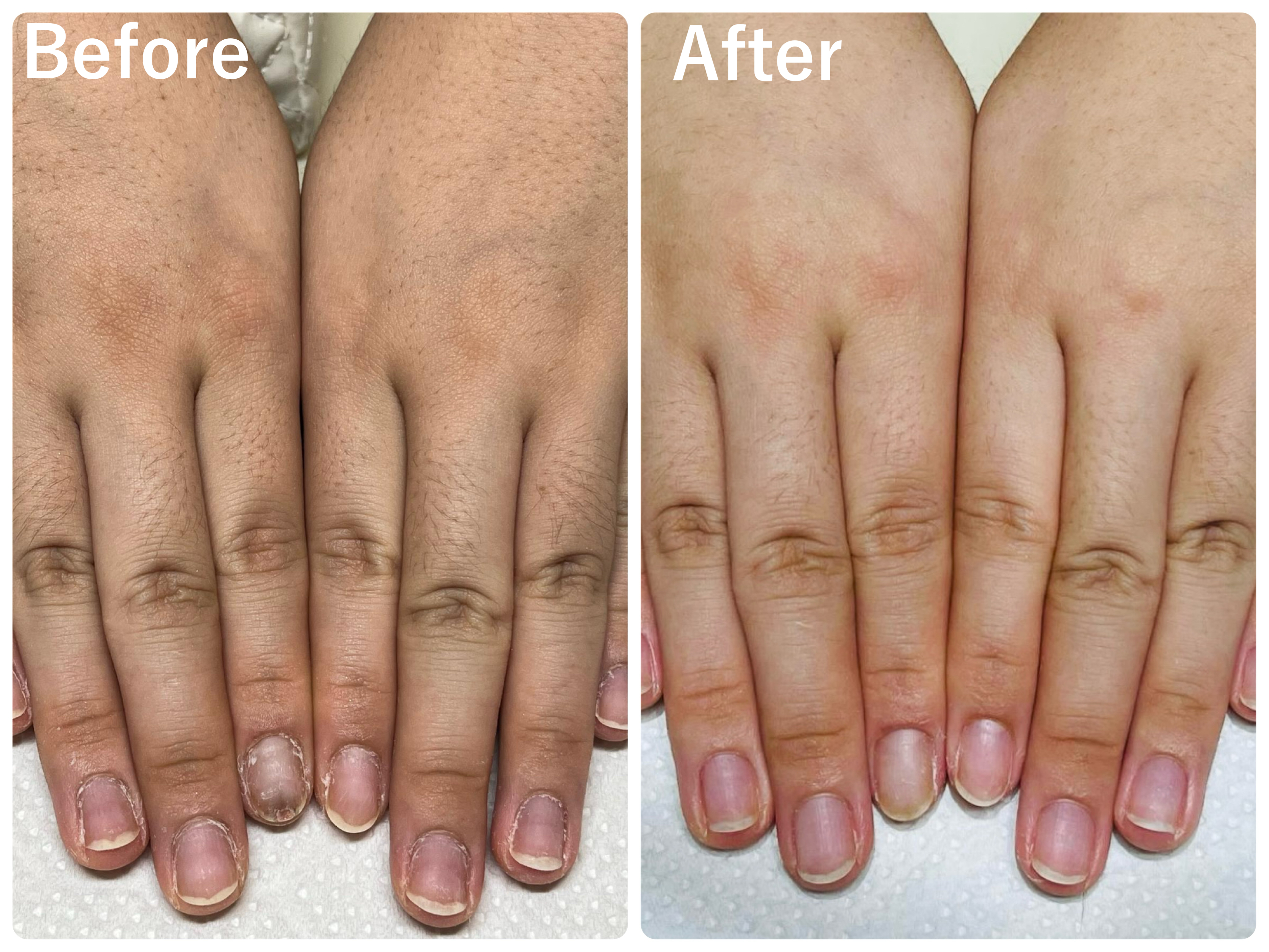 例：深爪矯正、手の若返りコース、血流改善コース